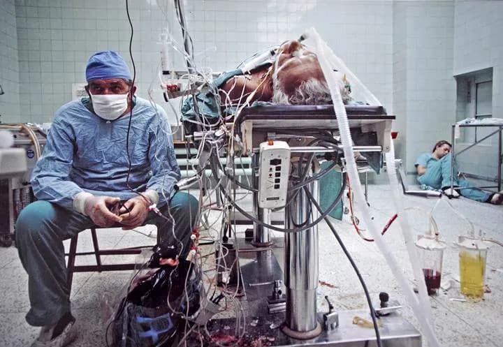 Kto zrobił pierwszy przeszczep serca na świecie i jak to zmieniło medycynę?