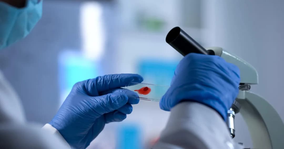 HIV kiedy odkryto – szokujące fakty o zidentyfikowaniu wirusa